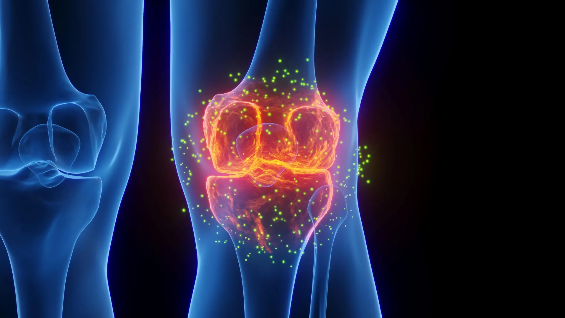 Stanford scientists regrow lost cartilage and reverse arthritis in major breakthrough